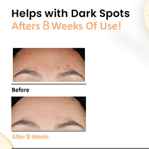 SKIN RENEWING SERUM - GLYCOLIC ACID 10% + CERAMIDES