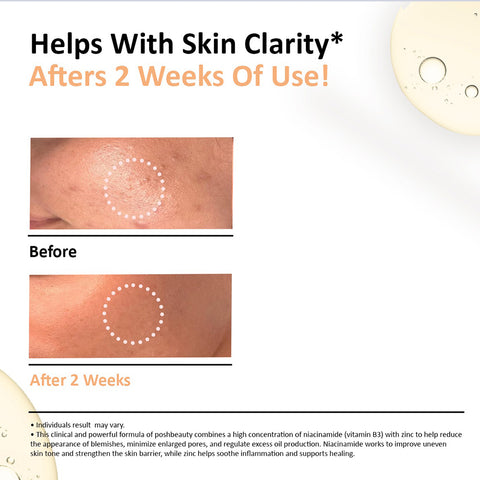 DARK SPOT CORRECTOR - Niacinamide 10% + Zinc 1%